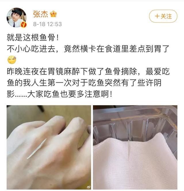 张杰吃鱼横卡食道，网友：你都四十岁的人了，怎么回事！