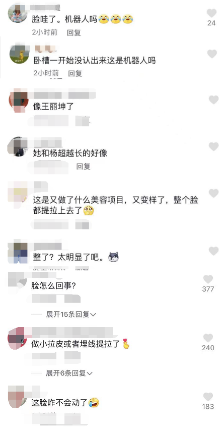 张雨绮新恋情曝光，笑起来表情极不自然，网友：整了吗