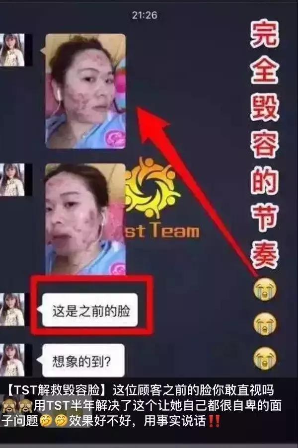 张庭林瑞阳出事，娱乐圈还有救吗？