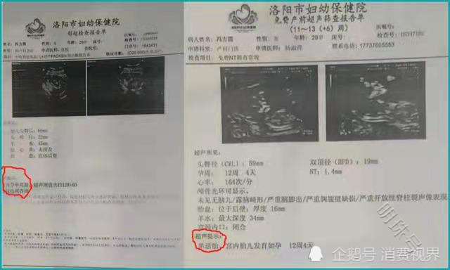 河南洛阳：医院出现“死胎复活”妇幼保健院回应“医生太年轻”？