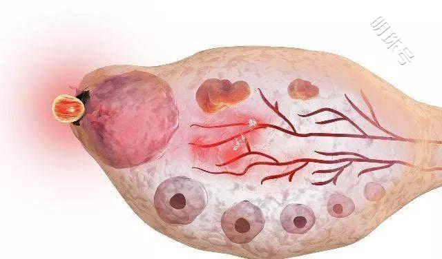 关于“卵泡发育”大家问的最多的5个问题，答案都在这里了！