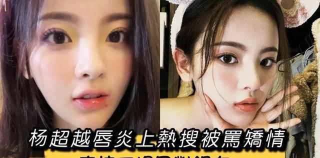 杨超越唇炎上热搜被骂矫情！直接下场回怼网友！美女实惨！