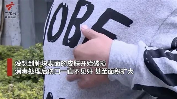 我得了乳腺癌？可我是男的啊！