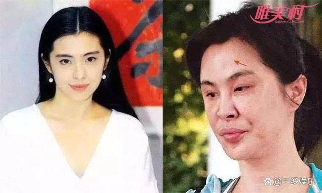 整容失败的三大女星，女神王祖贤变硅胶脸