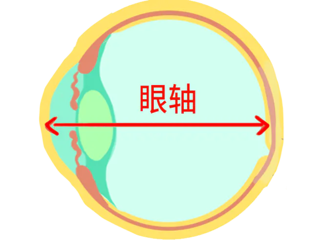 友华普惠丨近视度数越深，失明几率越高？医生：没错！