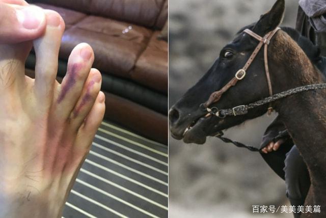 知名男星张翰拍戏太敬业！手掌被钉子扎出血，脚趾头被马踩出淤青