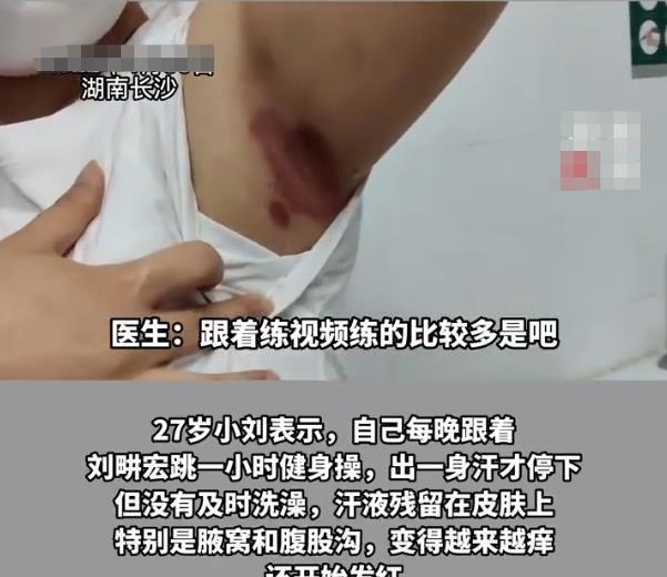 27岁女孩跟刘畊宏跳操，洗澡不及时，腋窝溃烂，网友：纯属碰瓷