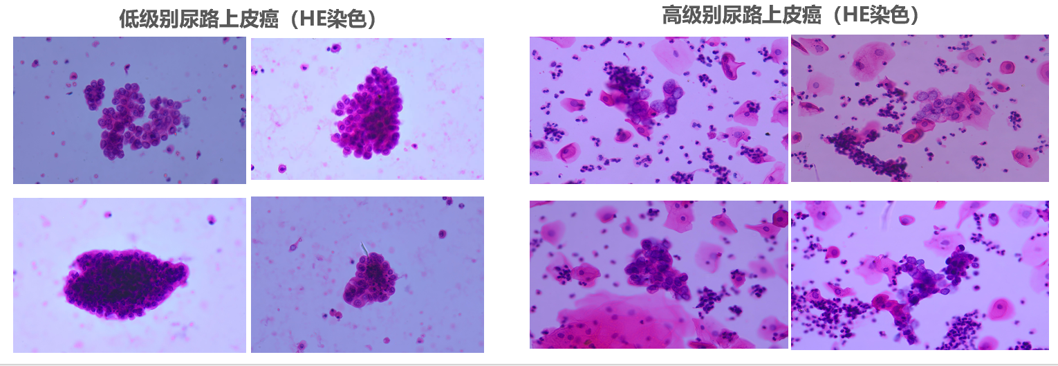 邻得膜：尿液中的核孔膜