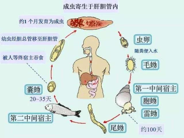 哪些人容易感染肝吸虫病?_资讯频道_东方养生