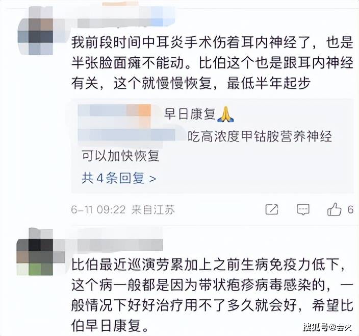 贾斯汀比伯患亨特氏综合征，半张脸已无法控制