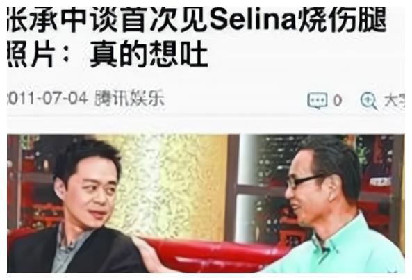 娶了毁容后的Selina，看似感情很好，张承中却说：自己想吐