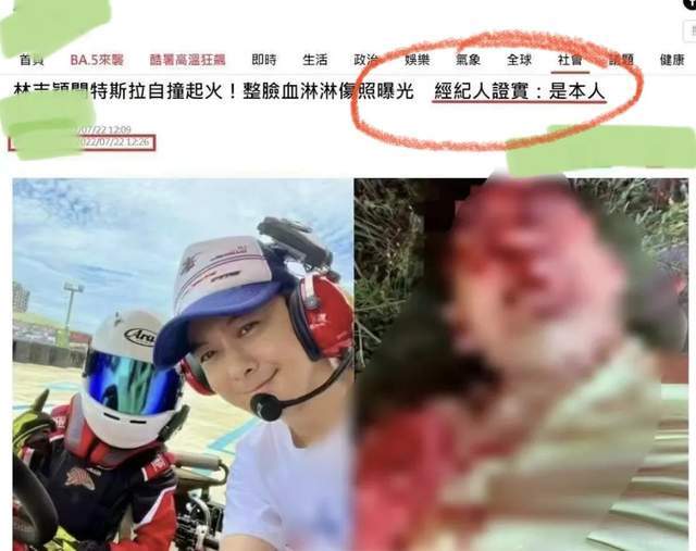 车祸细节曝光：林志颖满脸是血，6岁儿子疑似坐副驾