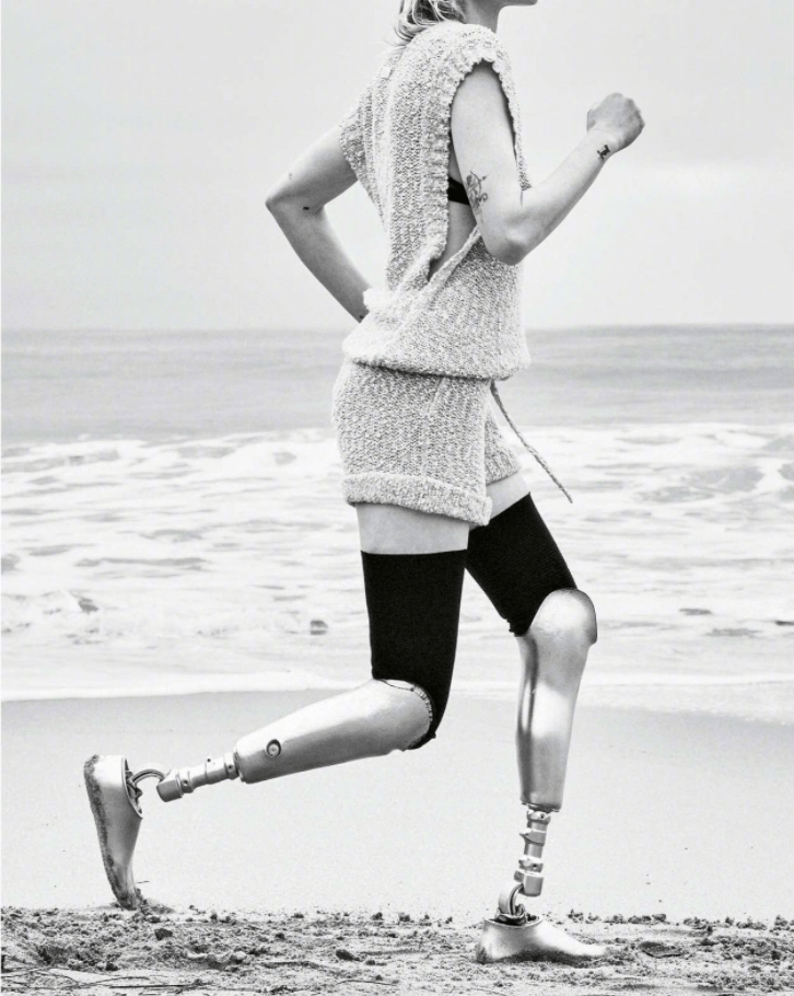 “金腿”超模最新时尚大片来袭，出生超模世家，却因卫生棉条截肢