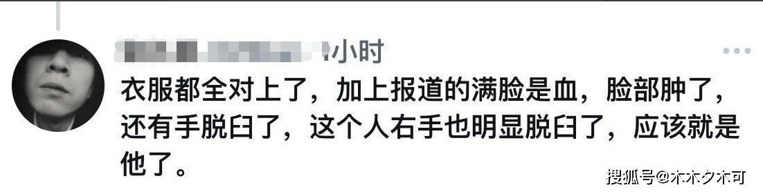 警方通报林志颖车祸原因，经纪人疑似被打脸，林志颖面部或将整形