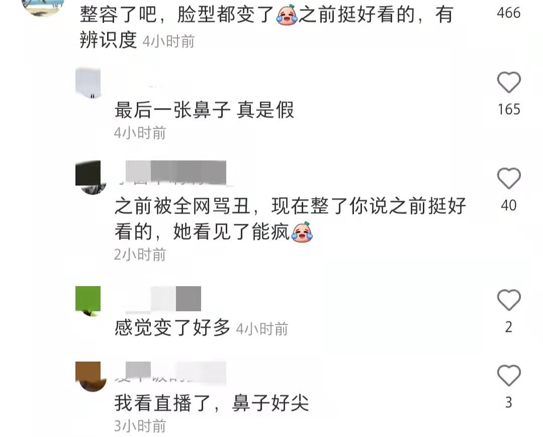 袁姗姗武汉过早被偶遇，穿毛线背心露肚脐，鼻子高耸被质疑整容