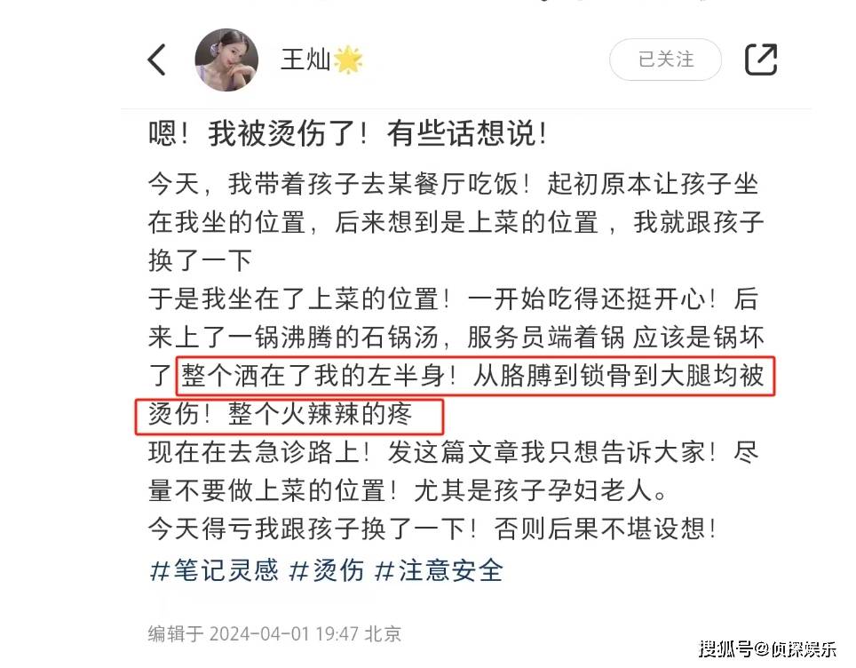 杜淳老婆带男儿吃饭，左半身被沸汤烫伤，红运实时跟孩子换了位置