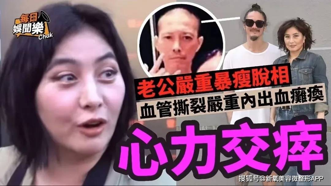 和赌王家花1亿给老公换血的这对比起来，何猷君奚梦瑶真像假的…