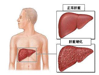 3:肝区,肩部疼痛癌细胞在肝脏中出现后,由于癌细胞不断吸收人体的