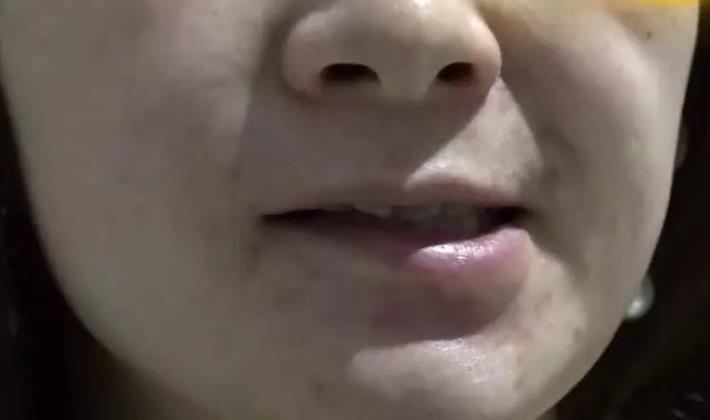 有时“口不对心”，甚至出现嘴角歪斜、流口水等都可能是脑血管病前兆。
