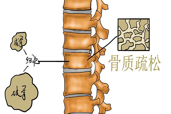 50岁之后，女性为什么容易犯困，还总觉得疲惫，浑身乏力？