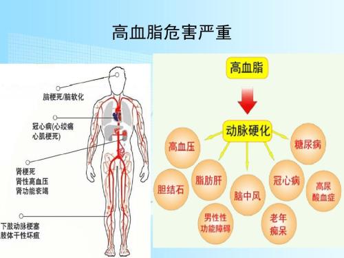 生活中控制这12条！能有效的预防脑梗死！关键看自己能不能做到！