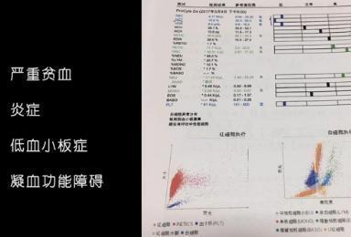 流浪折耳猫无人敢要被朋友收留，医生检查后失声哭泣！