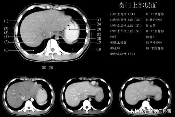 快速掌握——腹部CT