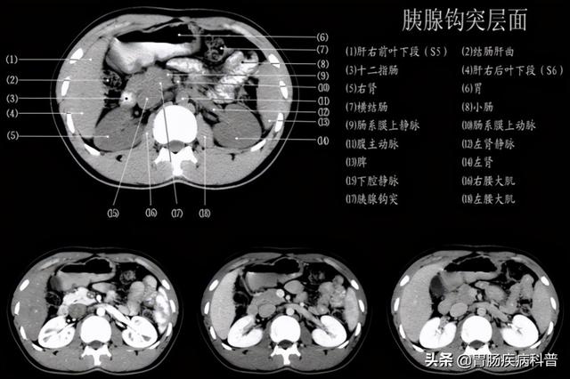 快速掌握——腹部CT