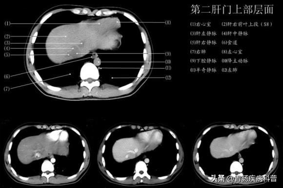 快速掌握——腹部CT