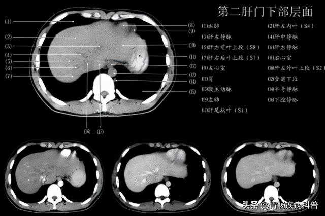 快速掌握——腹部CT