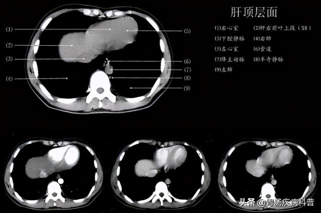 快速掌握——腹部CT