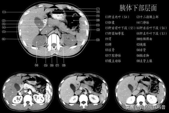 快速掌握——腹部CT