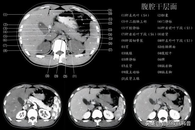 快速掌握——腹部CT