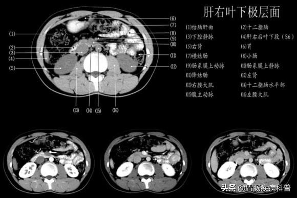 快速掌握——腹部CT