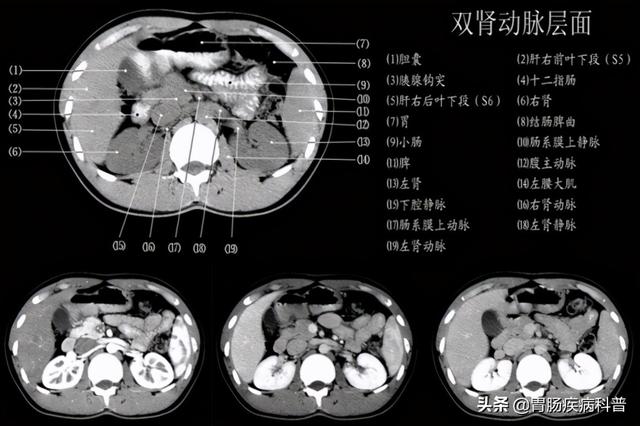 快速掌握——腹部CT