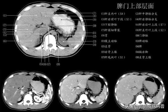 快速掌握——腹部CT