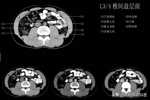 快速掌握——腹部CT