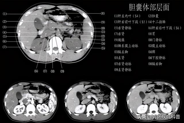 快速掌握——腹部CT