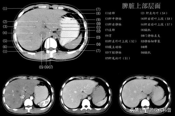 快速掌握——腹部CT