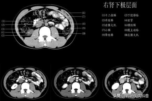 快速掌握——腹部CT