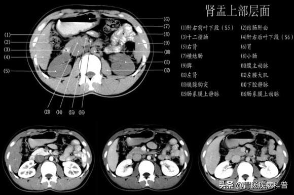 快速掌握——腹部CT