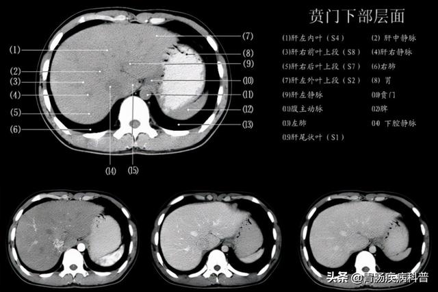 快速掌握——腹部CT