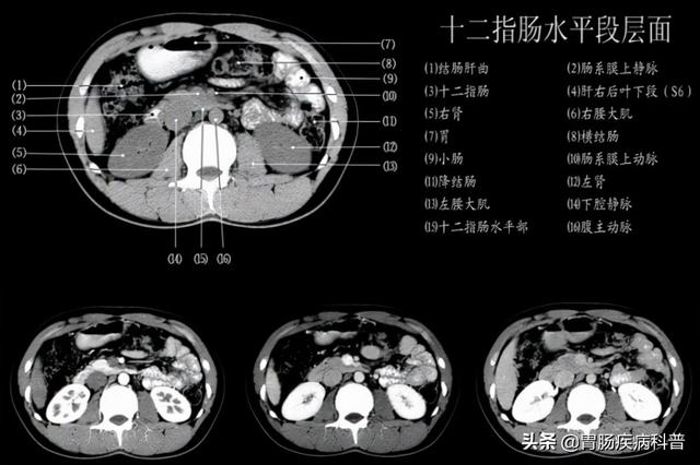 快速掌握——腹部CT