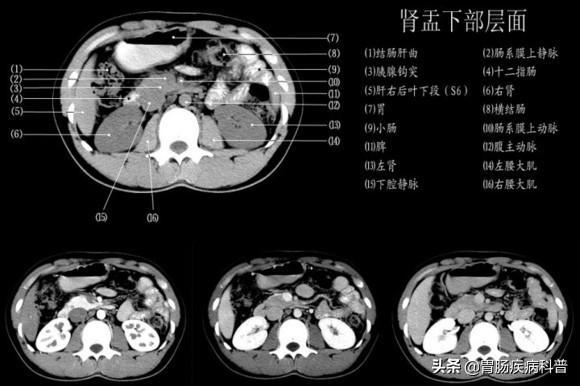 快速掌握——腹部CT