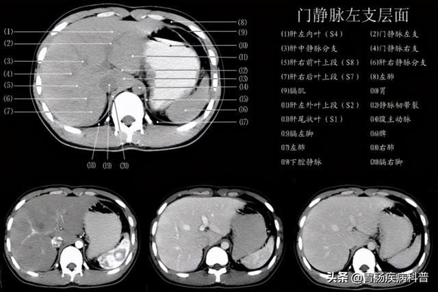 快速掌握——腹部CT