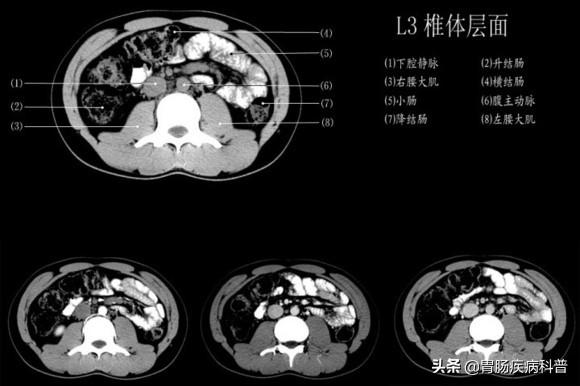 快速掌握——腹部CT