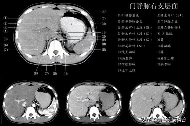 快速掌握——腹部CT