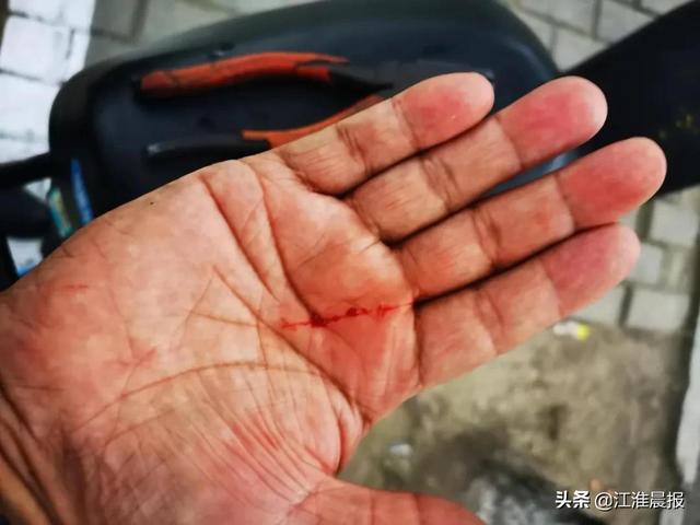 可恶！共享电单车坐垫里藏刀片，蚌埠一市民被划伤