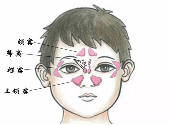 儿童鼻窦炎易被误诊为感冒,如何治疗才有效?常用的方法有5种