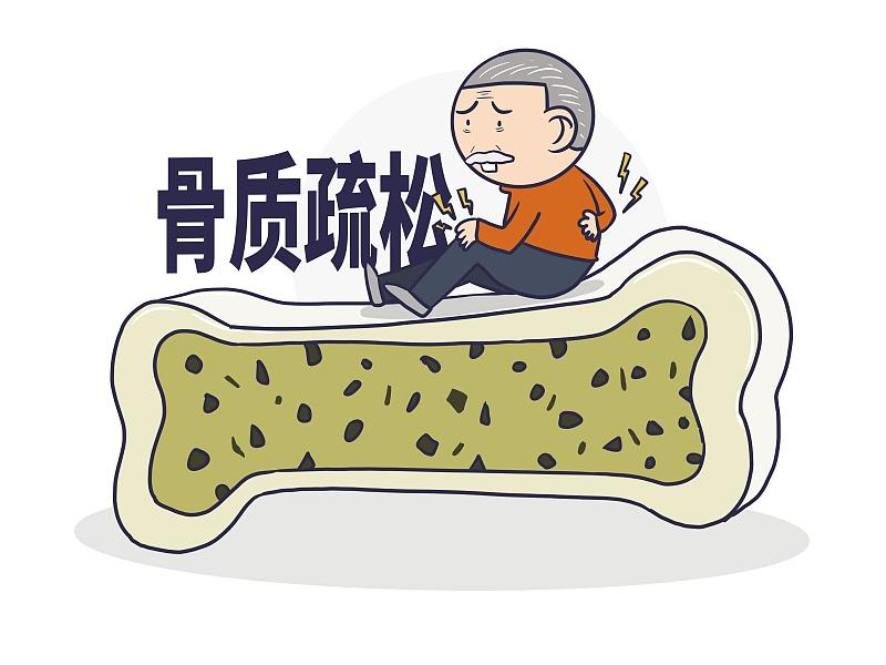 比酒水还伤骨？医生提示：骨不好的人，少吃这3种食物